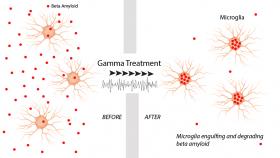 Gamma oscillation brain waves suppressed beta amyloid production and invigorated microglia