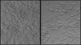 Pictured are MCF-7 human breast cancer cells, stably transformed with SNAIL (right) or an empty vector control (left). Cells expressing SNAIL show an increased mesenchymal phenotype and malignant characteristics. The control cells display a cobblestone morphology, whereas cells overexpressing SNAIL are more elongated. Credit: MgGrail, et al., FASEB 2014.