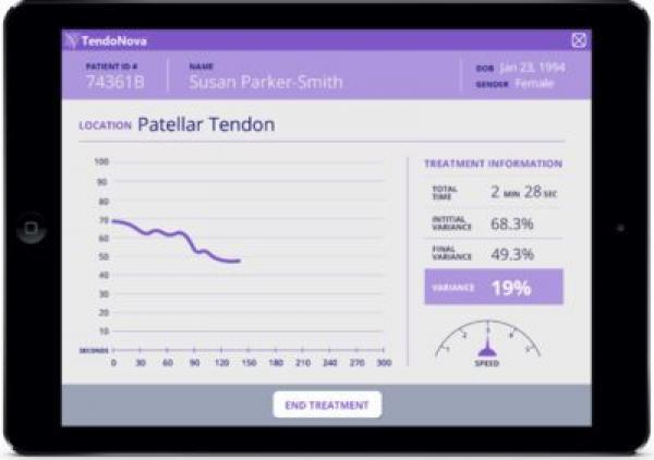 TendoNova™ provides physicians with real-time biofeedback to simplify and standardize percutaneous tenotomy procedures