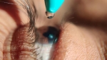 Researchers Find New Drug Can Quickly Reverse Eye Pressure Increases from Steroid Eye Drops Researchers Find New Drug Can Quickly Reverse Eye Pressure Increases from Steroid Eye Drops