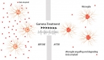 Noninvasive Visual Stimulation May Illuminate a Path for Alzheimer’s Disease Treatment Noninvasive Visual Stimulation May Illuminate a Path for Alzheimer’s Disease Treatment