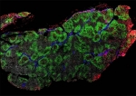 New PET/CT Scanning Approach Could Help Accelerate mRNA Vaccine Development New PET/CT Scanning Approach Could Help Accelerate mRNA Vaccine Development