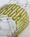 Stretchable Wireless Sensor Could Monitor Healing of Cerebral Aneurysms Stretchable Wireless Sensor Could Monitor Healing of Cerebral Aneurysms