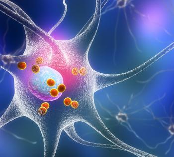 Parkinson's disease. 3D illustration showing neurons containing Lewy bodies, small red spheres which are deposits of proteins accumulated in brain cells that cause their progressive degeneration. (Licensed from Big Stock Photo)