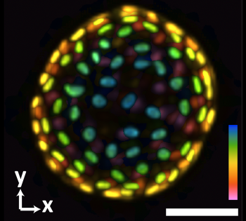An image of a colon organoid captured by a new system developed in Shu Jia’s lab that can capture dynamic, 3D information about the lab-grown cultures of tissues in a single image. The raw image was captured in 0.1 seconds. The coloration represents depths of 60 and -60 micrometers from the focal plan to depict the organoid in three dimensions. (Image Courtesy: Shu Jia & Wenhao Liu)