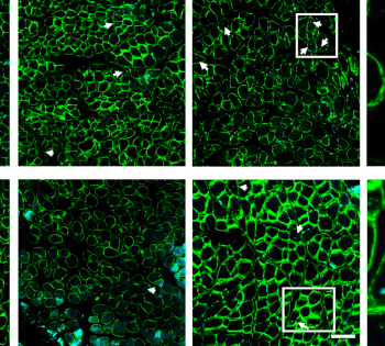 rotator cuff hero image