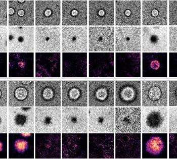 CD40 and CD40L interactions