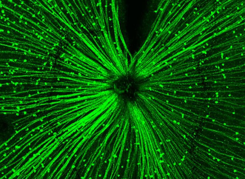 The expression pattern of the photoreceptor protein OPN5 in a mouse retina. The protein is sensitive to violet light and, as reported in a new study from a group of international researchers, plays an important role in the ability of violet light to stop the progression of myopia. This violet light effect has been previously reported, but now researchers are beginning to understand how it works. The prevalence of myopia has been growing worldwide, and it is especially common in Asian countries.