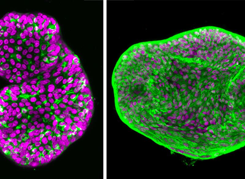Organoids