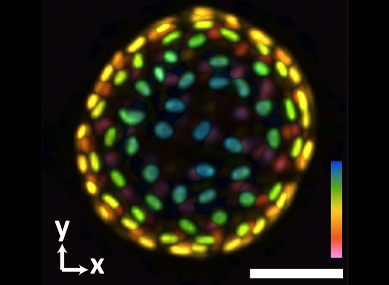 An image of a colon organoid captured by a new system developed in Shu Jia’s lab that can capture dynamic, 3D information about the lab-grown cultures of tissues in a single image. The raw image was captured in 0.1 seconds. The coloration represents depths of 60 and -60 micrometers from the focal plan to depict the organoid in three dimensions. (Image Courtesy: Shu Jia & Wenhao Liu)