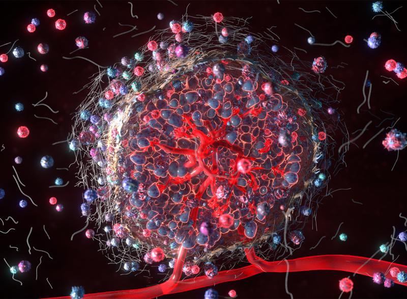 tumor