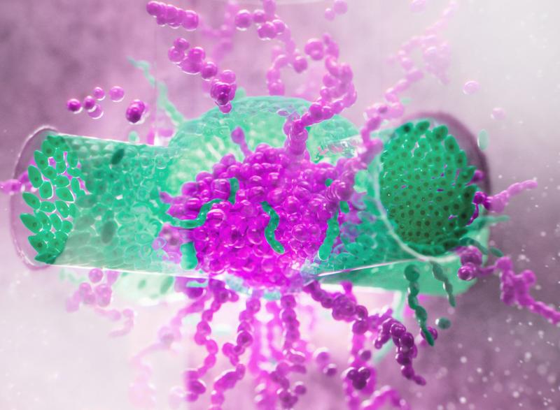 A magenta and green artist's rendering of Serpooshan's 3D printed pediatric neuroblastoma model.